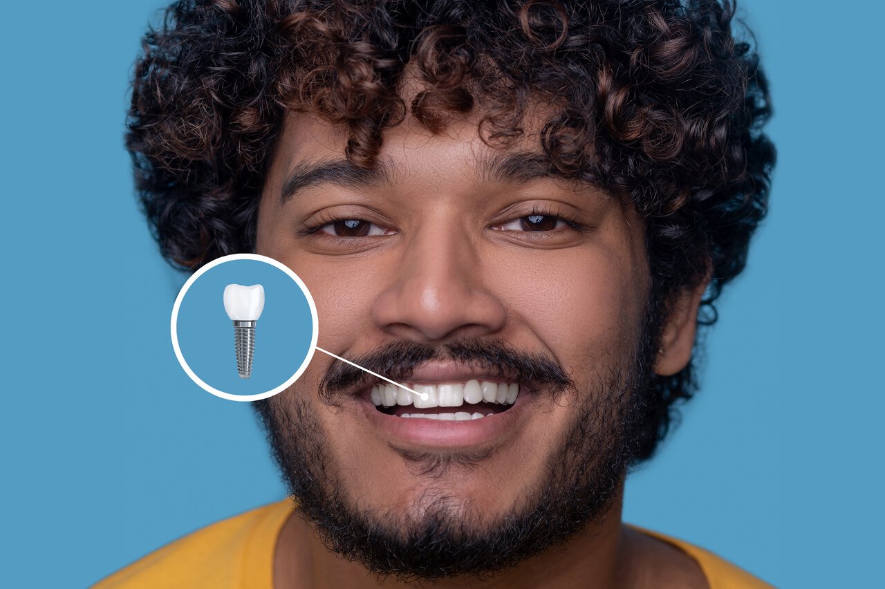 Homem sorrindo com um implante dentário em destaque.